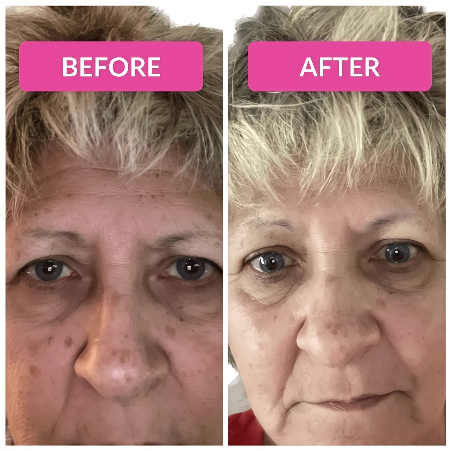 Super C Serum
